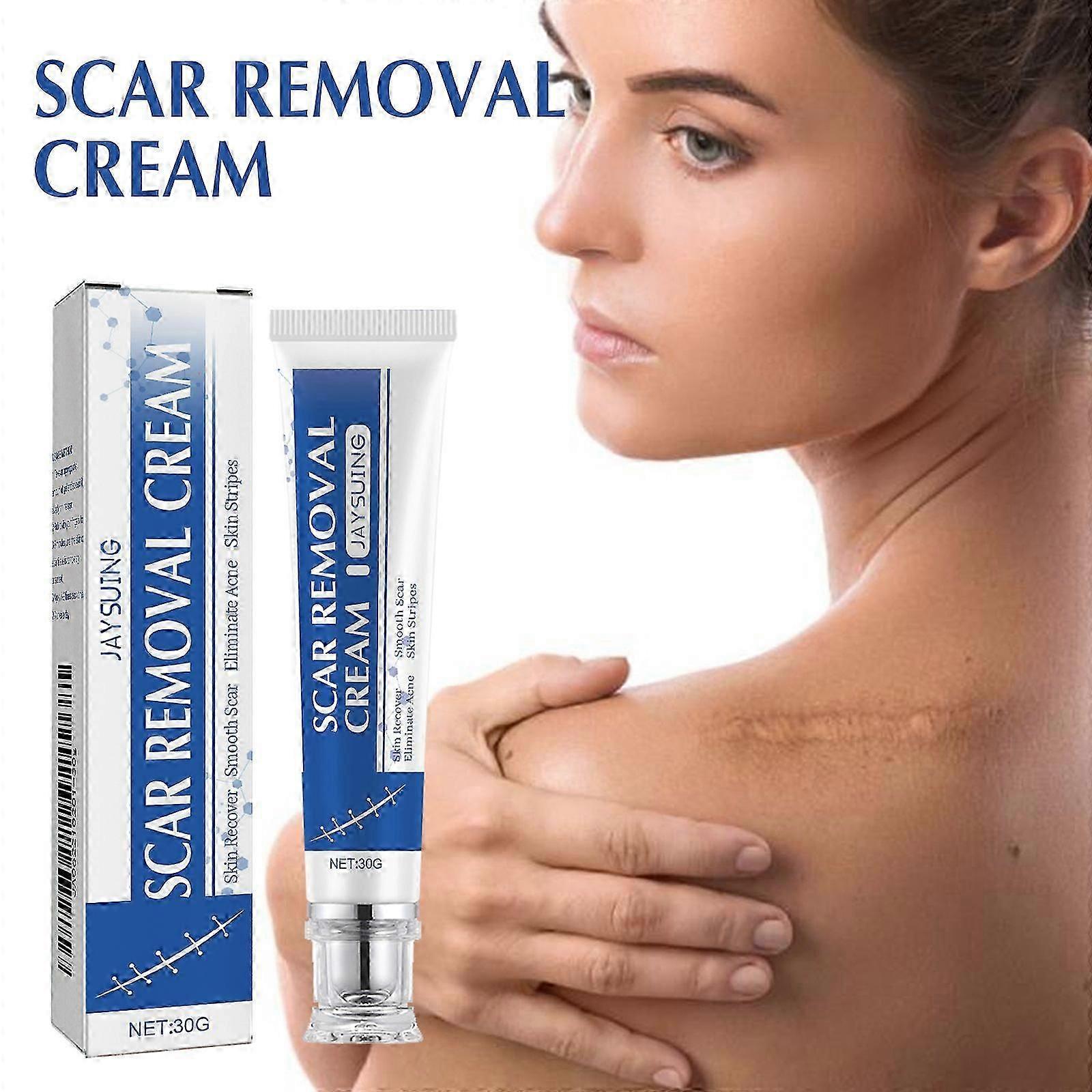 Scar Removal Cream - minskar Àrr och hudbristningar
