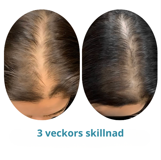 HårBoost Roll-On - För snabbare & starkare hårväxt